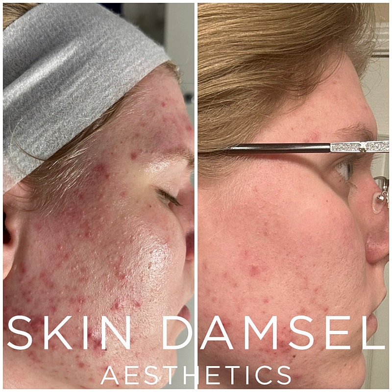 DiamondGlow Gallery Before & After